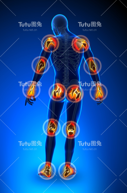 关节疼痛-满图