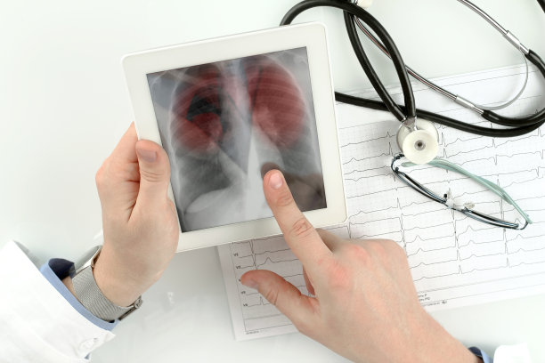 医生在看肺部x光片，肺炎照片。新型冠状病毒肺炎